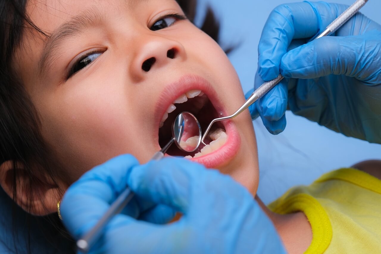 Image for Waarom hebben zoveel kinderen in Nederland cariës?