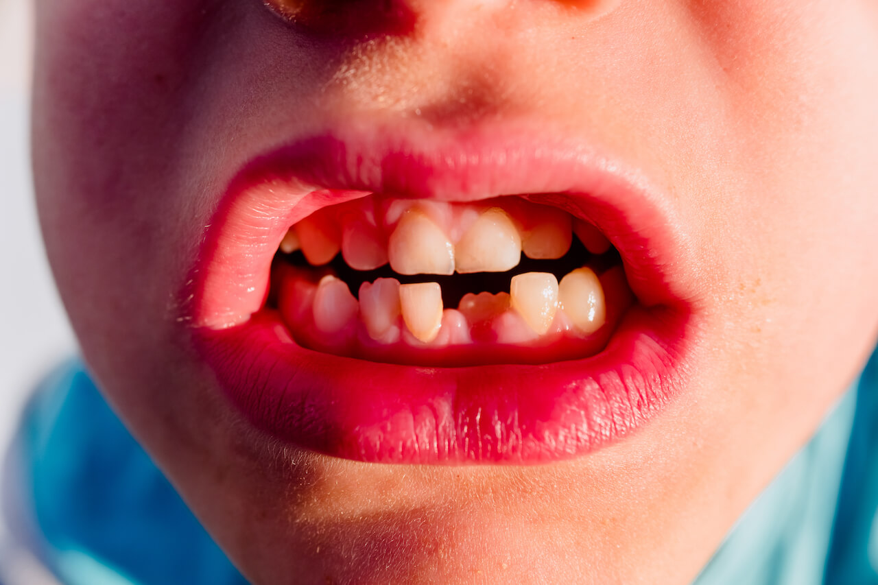 Image for Ontwikkeling melkgebit en blijvend gebit