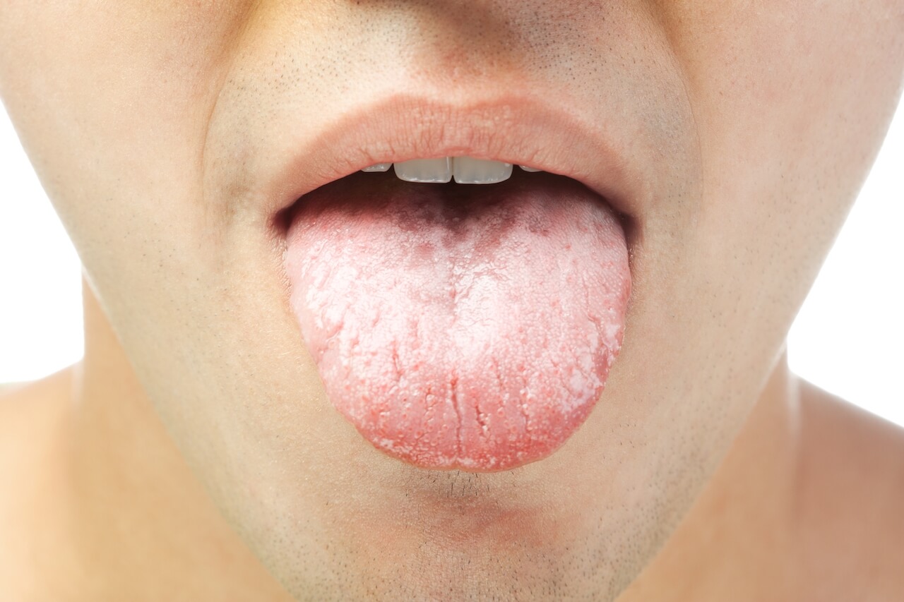 Image for Tongschraper