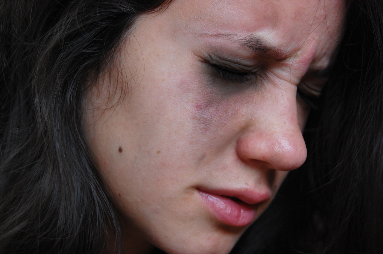 Image for Angst in de tandheelkunde