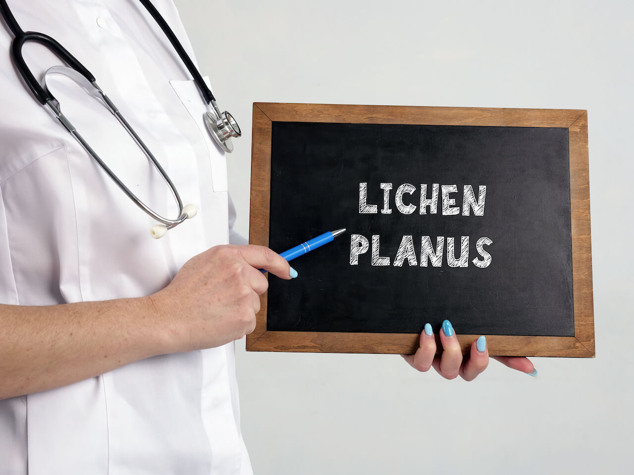 Image for Lichen planus in de mond