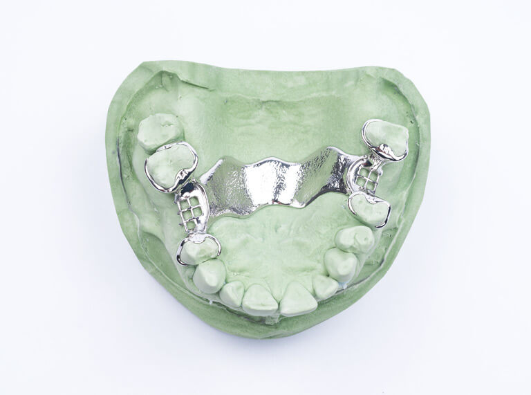 Image for Een frameprothese