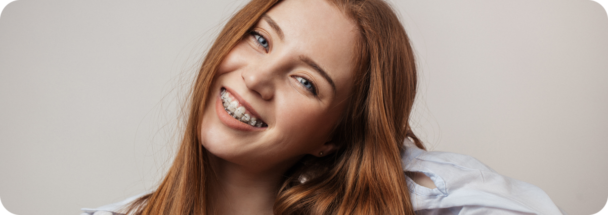 Alles wat je moet weten over aligners en Invisalign bij Tandartspraktijk Westerhage in Breda