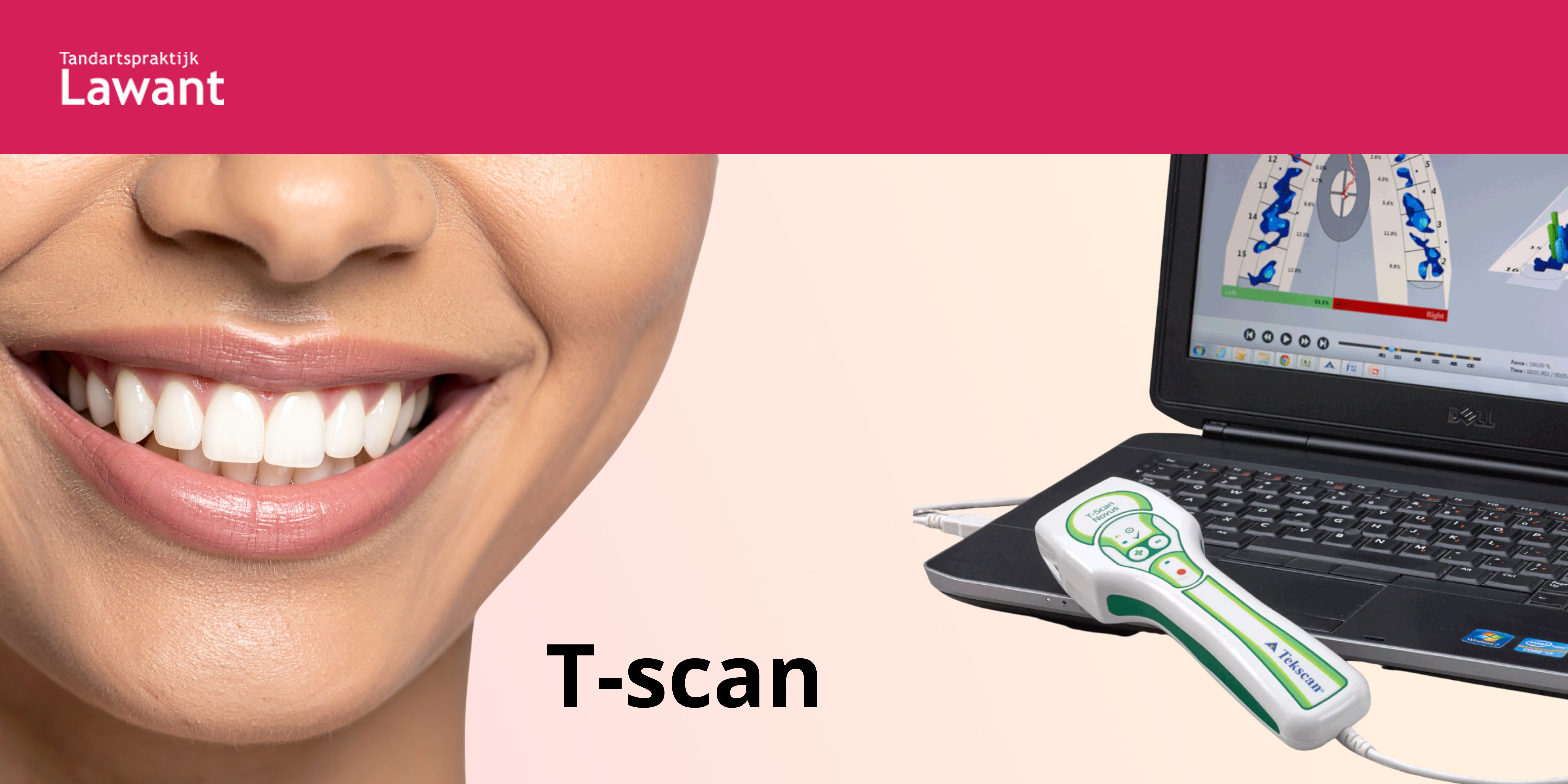 Moderne Tandheelkunde met T-Scan bij Tandartspraktijk Lawant