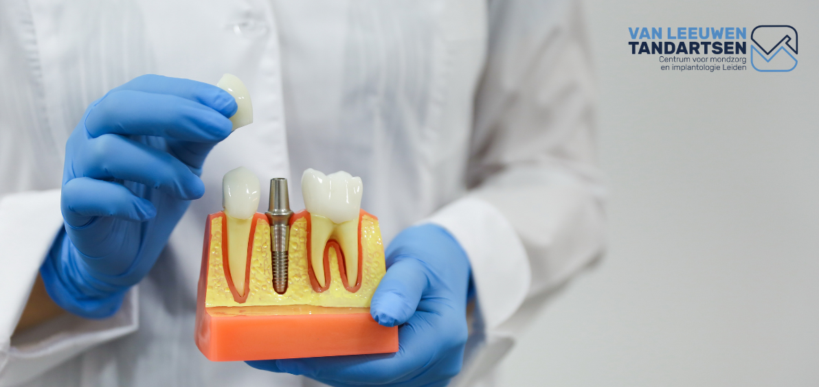 Van Leeuwen Tandartsen