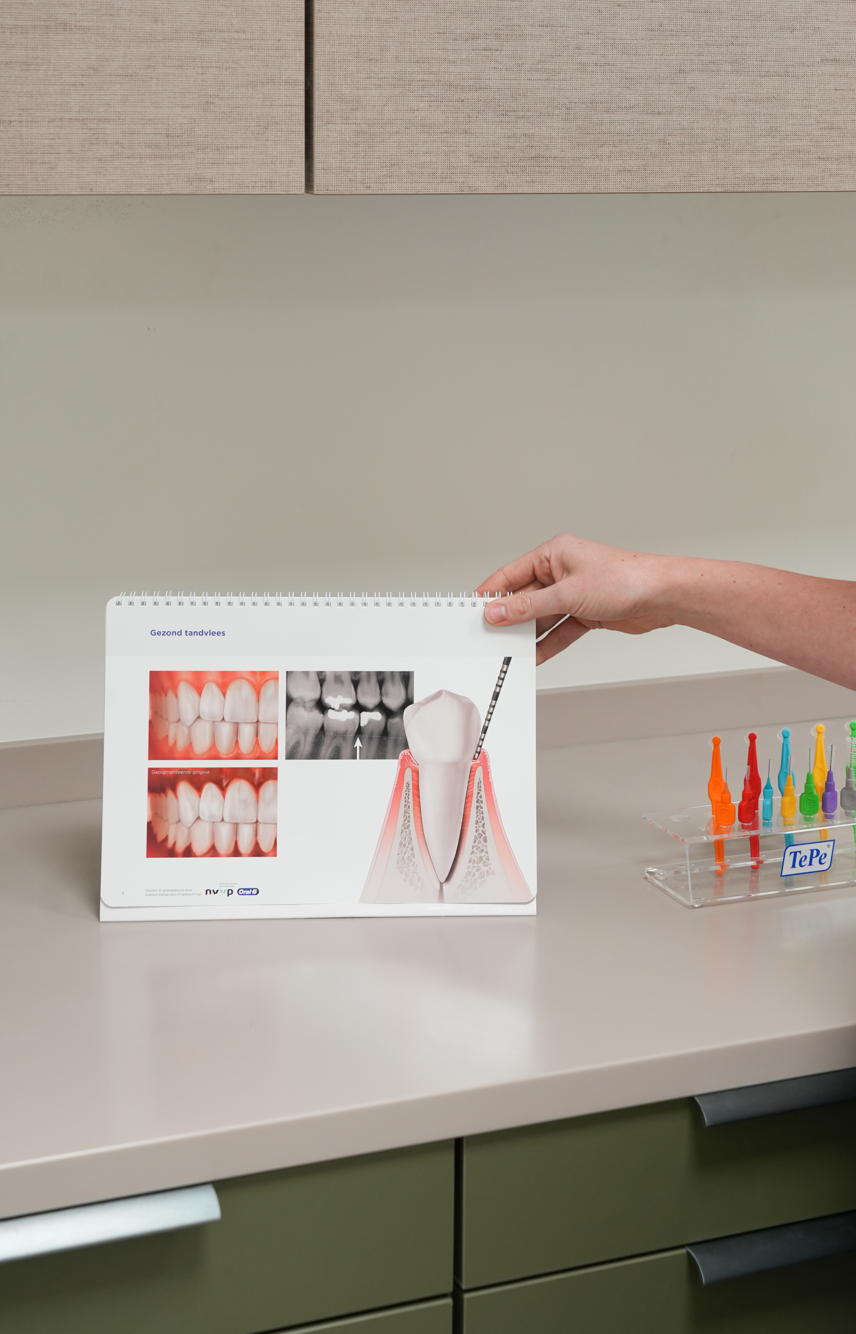 Gingivitis en parodontitis: twee veelvoorkomende tandvleesaandoeningen