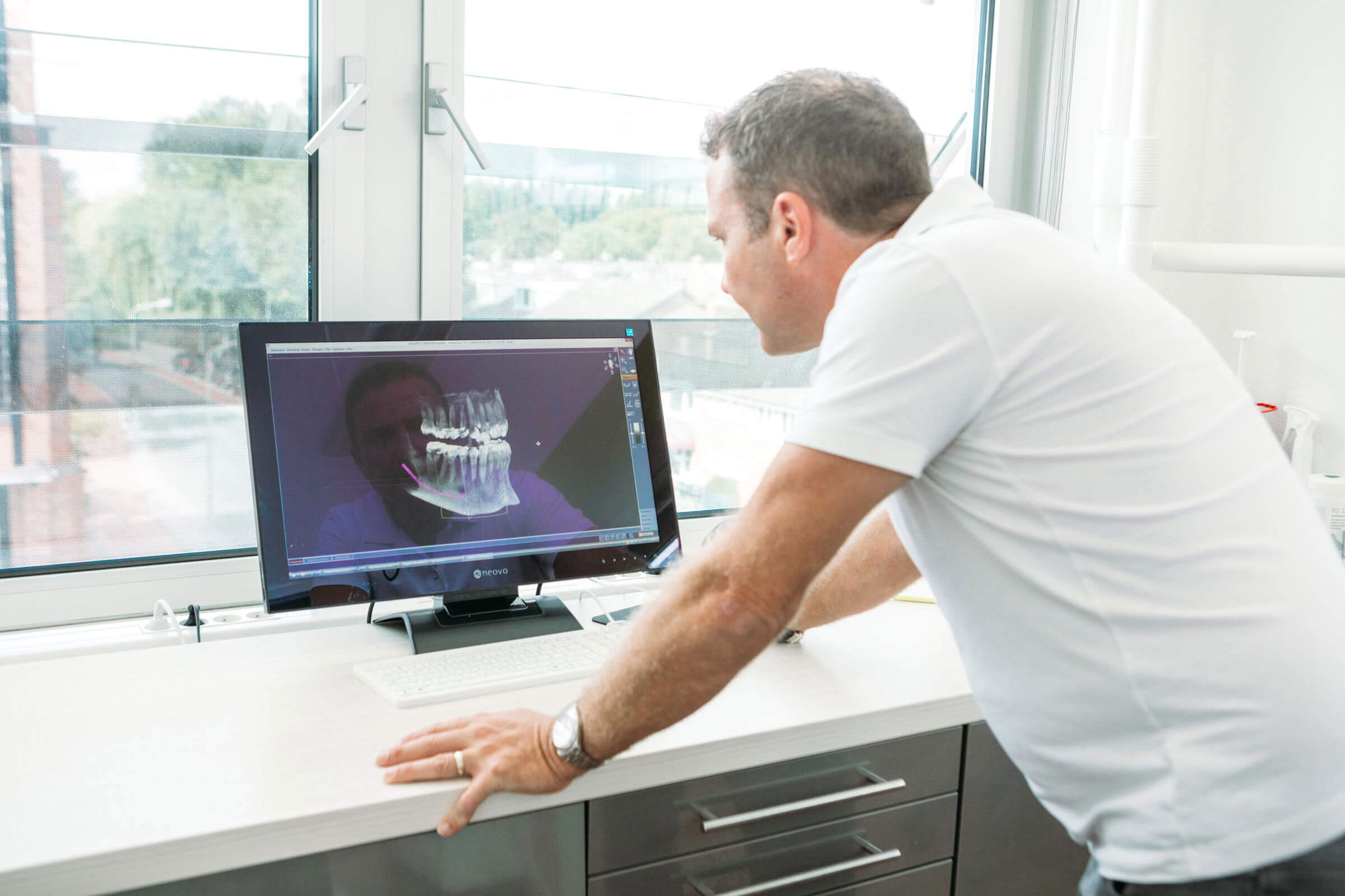 CEREC kronen 