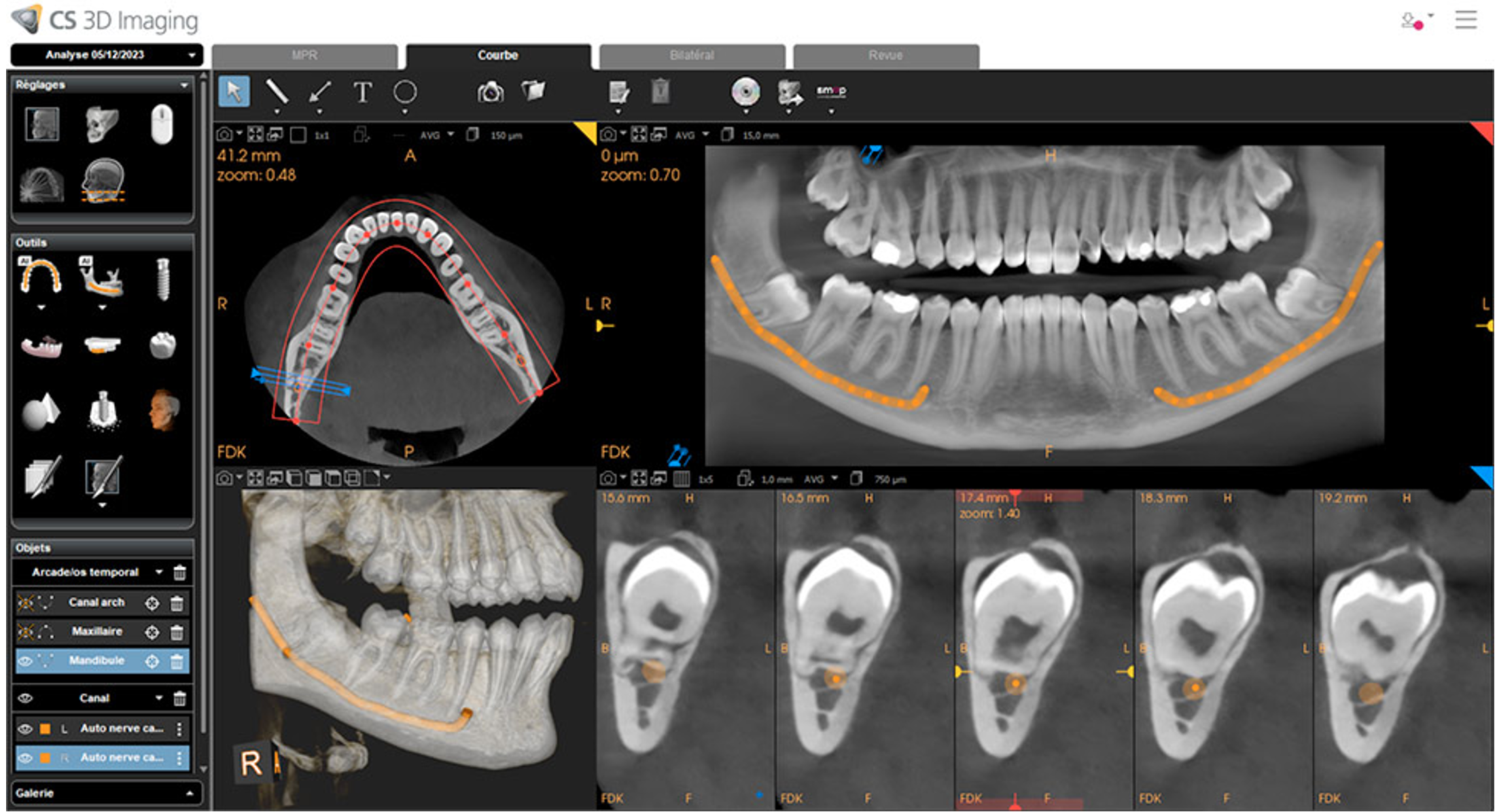 3D scan