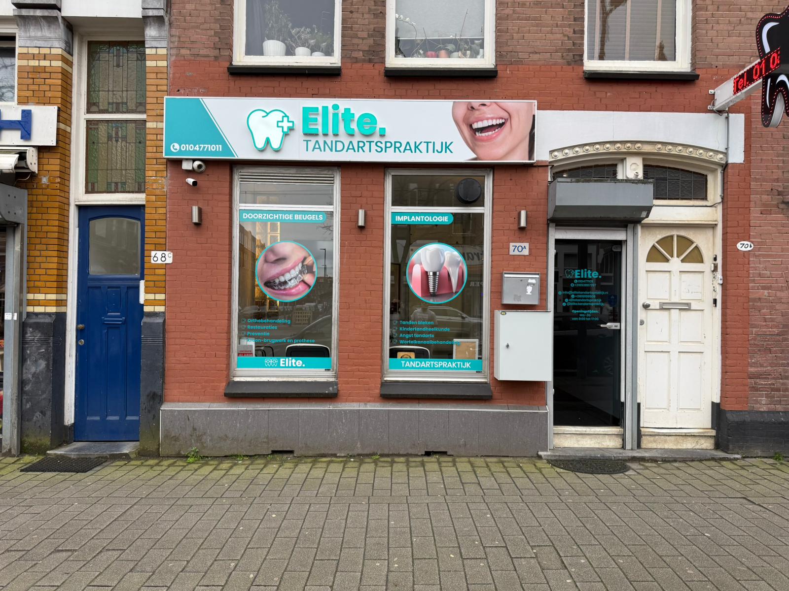 Kunstgebit voelt los? Ontdek de juiste prothese-oplossing bij Elite Tandartspraktijk in Rotterdam-West