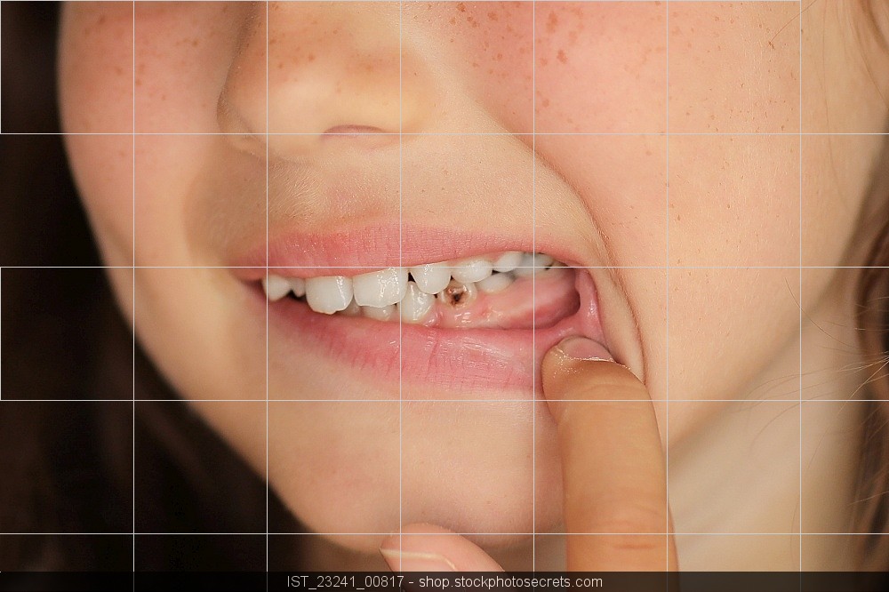 Image for Gaatjes?? Hoe kan dat nou? We poetsen onze tanden wel twee keer per dag!