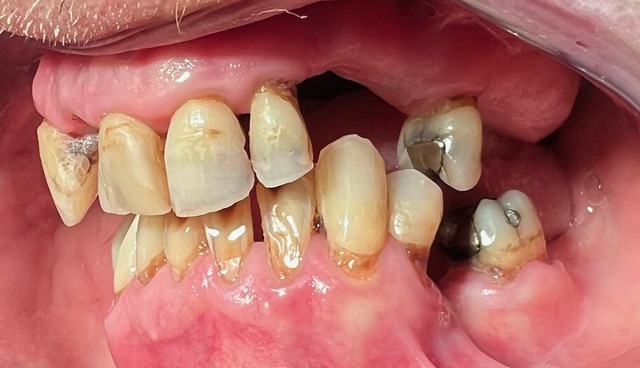 Image for Het verhaal van Kees