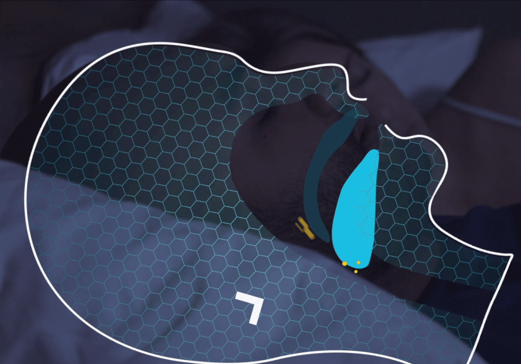 Image for De slaaptandarts vertelt over snurken en apneu.