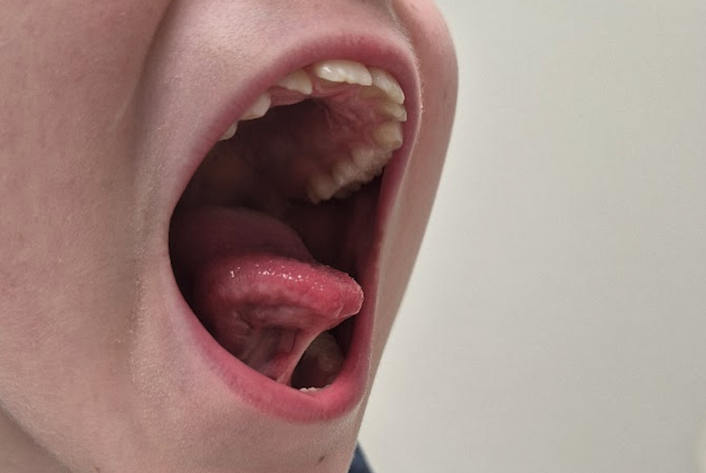 Image for De tongriem: Een klein stukje weefsel met grote gevolgen