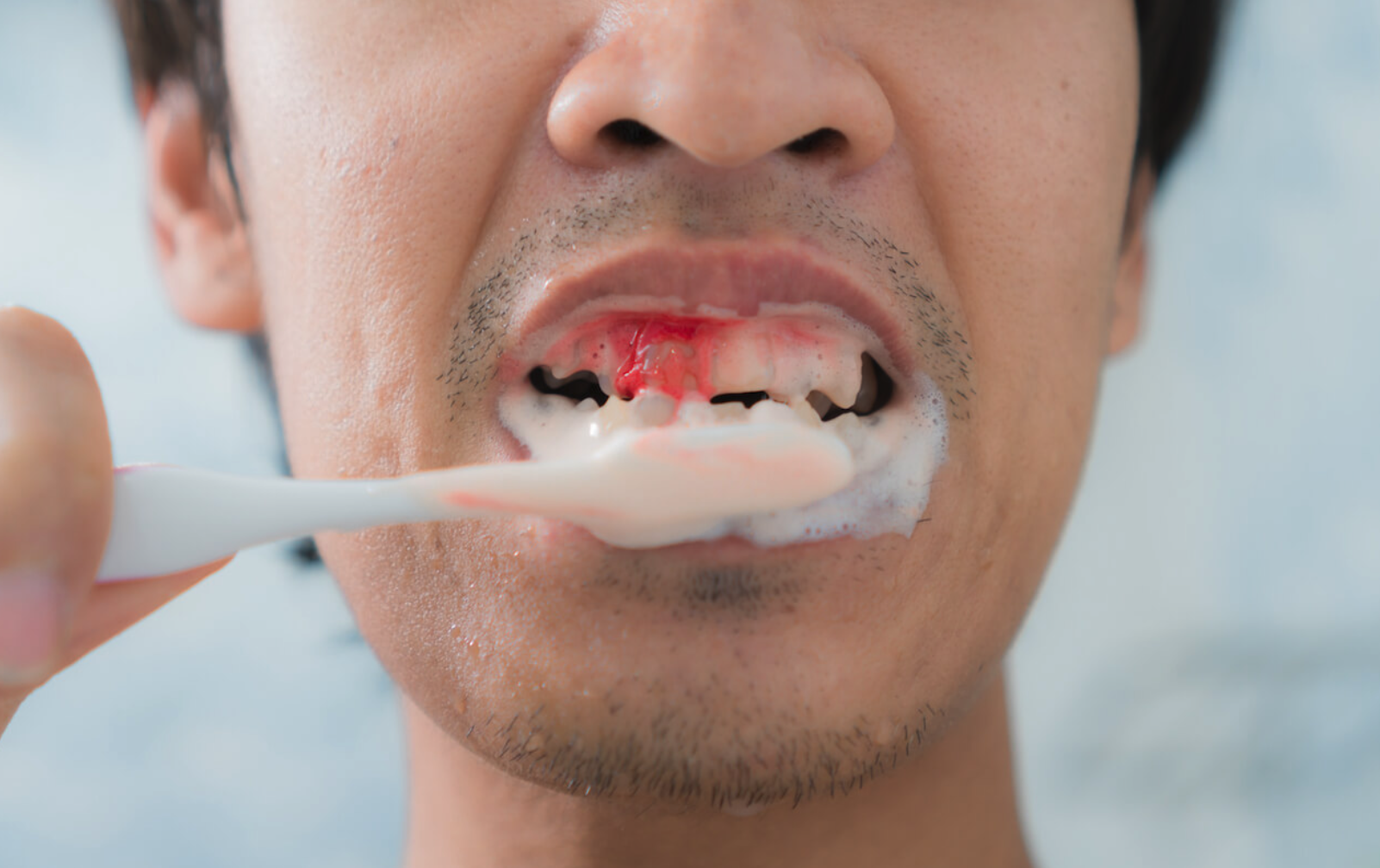 bloedend tandvlees poetsend