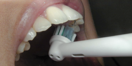 Bovenkant binnenzijde van de tanden en kiezen