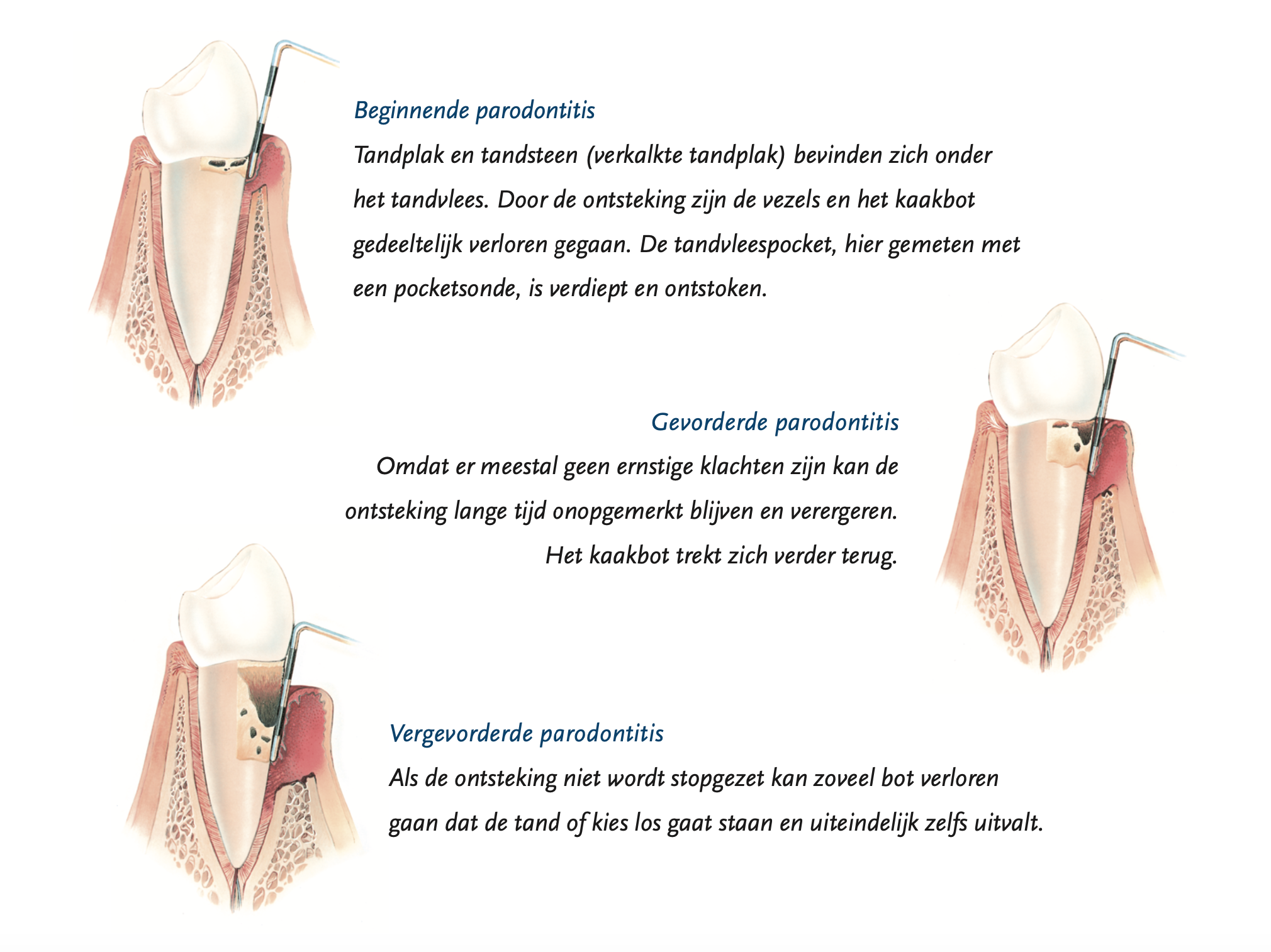 Fase van parodistisch 