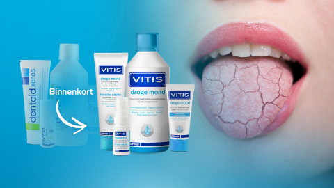 vitis hoofdfoto